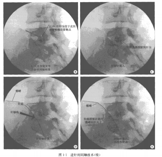 1533545151850308.png 112.png