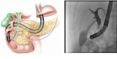1567672144857107.jpg 示意圖_副本.jpg